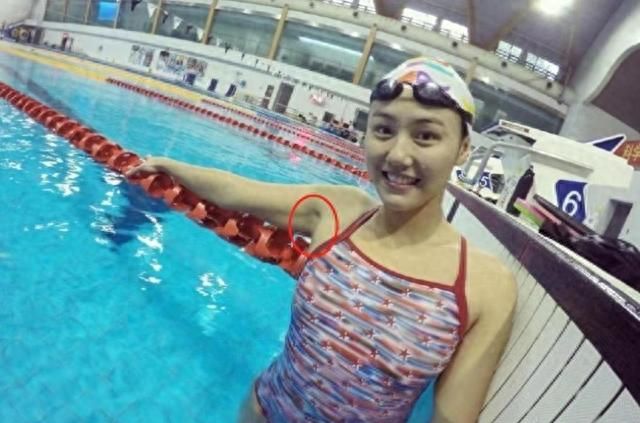 女运动员为何赛后忍痛扯泳衣?揭露她们背后的心酸遭遇图6