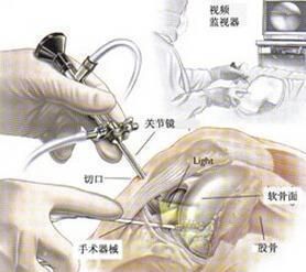 人体最容易受伤的关节是哪个关节图11