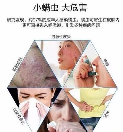 天气渐凉 如何防螨除螨虫(梅雨天被子除螨)图1