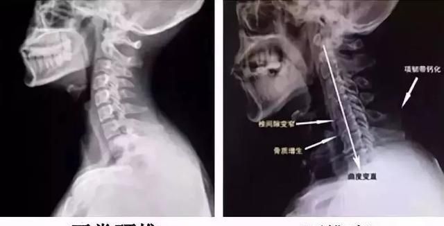为什么五星级酒店都用鹅绒枕,希尔顿鹅绒枕为什么这么便宜图37