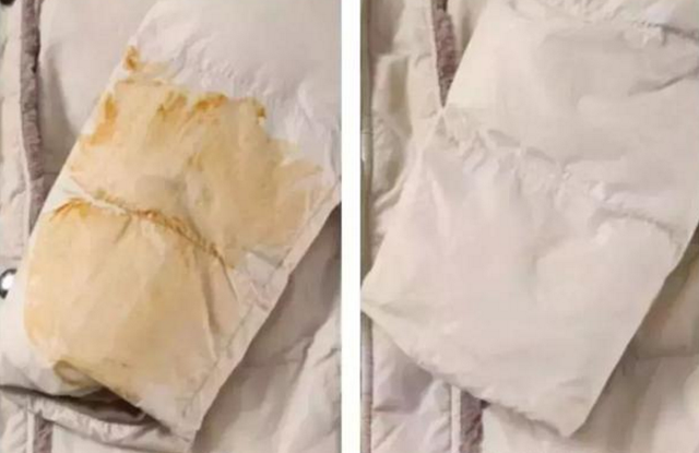 羽绒服发黄的洗不掉了咋办图4
