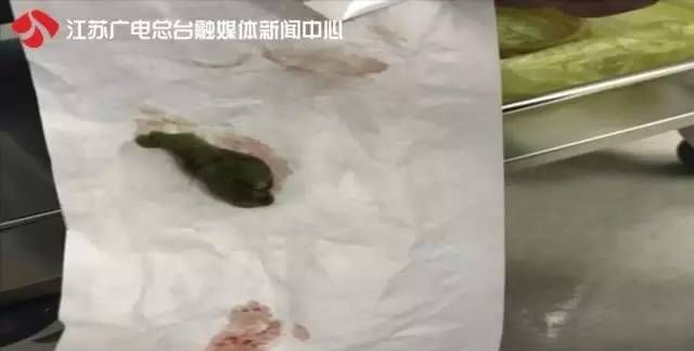 色素团是什么,青团里面有色素吗
图2